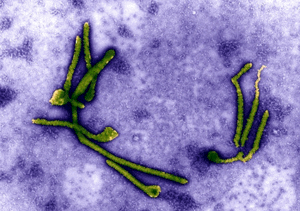 Image: Colored transmission electron micrograph (SEM) of a number of Ebola viruses, members of the filovirus group of viruses, and also the cause of Ebola fever (Photo courtesy of the Eye of Science).